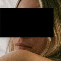 AloeForThatBurn Nude