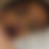 capdollaz Nude